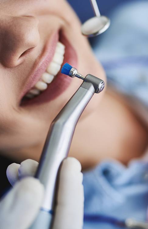 Dental appointment marked on calendar next to toothbrush