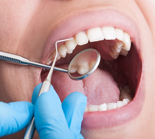 Girl in dental chair with dentist pointing to her smile