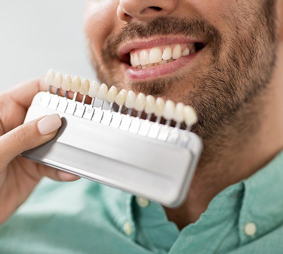 Man's smile compared with porcelain veneers shade chart