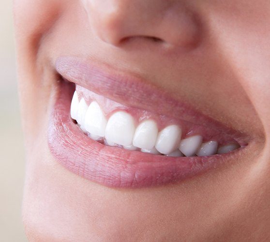 Closeup of smile after gum recontouring