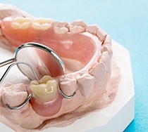 partial dentures sitting on a mold of a mouth