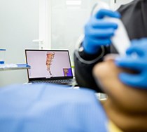 Dentist using an intraoral camera to take digital impressions