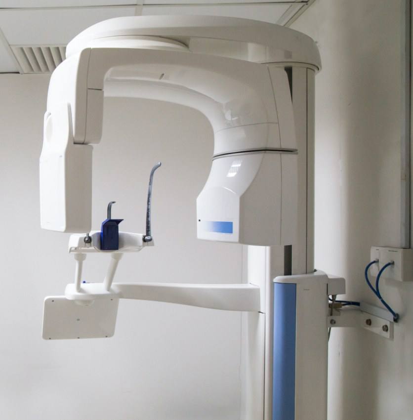 3 D C T cone beam x-ray scanner