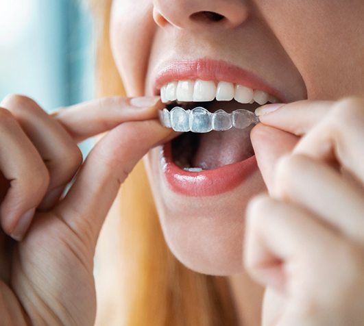 a person putting on Invisalign in New Bedford
