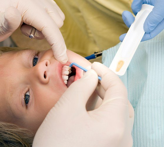 Dental patient receiving silver diamine fluoride treatment